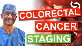 Survival and Staging in Colon and Rectal Cancer