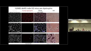 CRISPR-Cas9 Deletion Strategy that Targets the Majority of DMD Patients in hiPSC-derived Muscle