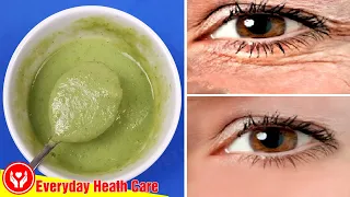 Apply This Mixture - Remove Eye Area Wrinkles Naturally And Change Your Skin