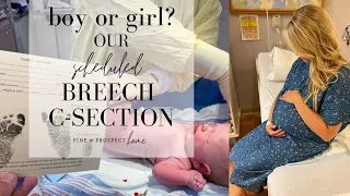 Breech C-Section | Boy or Girl?