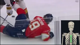 Matthew Tkachuk Chest Injury - Dr. Wilson Explains