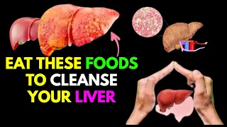 How to Cleanse Liver Fat The 10 Best Foods to Reverse Steatosis and the 10 Worst