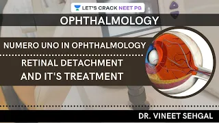 Numero Uno in Ophthalmology| Retinal Detachment and it's Treatment | NEET-PG 2021 | Vineet Sehgal