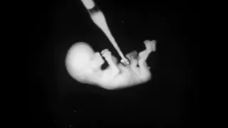 Fetal response to stimulus  1951 medical documentary