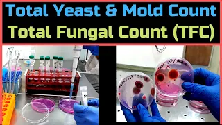Total Yeast & Mold Count (Total Fungal Count)_A Complete Procedure (BAM, Ch-18)
