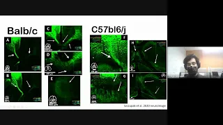 Secret pathways of the brain: the corpus callosum is a mainly... - Diego Szczupak (U Pittsburgh)