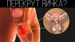 Перекрут яичка | Как понять, что у тебя перекрут яичка? | ПОЛЕЗНЫЙ ЮТУБ