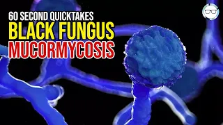 BLACK FUNGUS [MUCORMYCOSIS] Affecting COVID Patients - QuickTakes