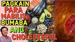 Pagkain Para Mabilis Bumaba ang Cholesterol - Payo ni Doc Willie Ong