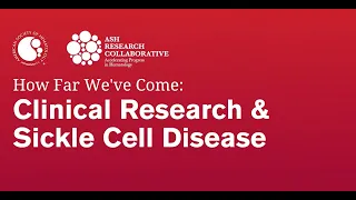 How Far We’ve come: Clinical Research and Sickle Cell Disease