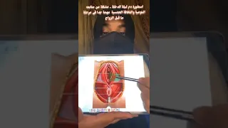 اسطورة دم ليلة الدخلة .. مشكلة متابعة