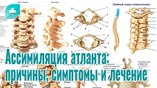 Ассимиляция атланта:причины, симптомы и лечение