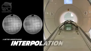 MRI INTERPOLATION – A BETTER UNDERSTANDING