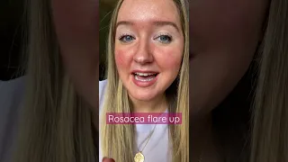 Rosacea flare up, close up 💖 #redness #rosacea #rosaceaawareness #rosaceawithrose #sensitiveskin