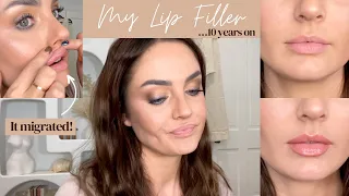 Looking Back at my Lip Filler Injections + My NEW Lip Plumping Routine