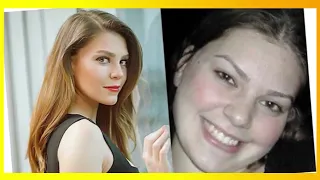 10 Turkish Actresses Before and After Surgery, Plastic Surgery, Turkish Drama