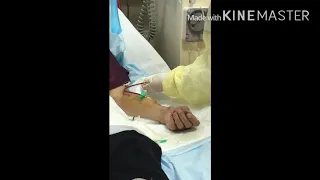 HEMODIALYSIS: AV FISTULA CANNULATION and CONNECTION