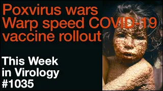 TWiV 1035: Poxvirus wars, warp speed COVID-19 vaccine rollout