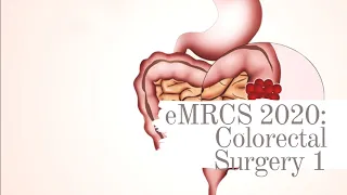 eMRCS 2020: Colorectal Surgery 1