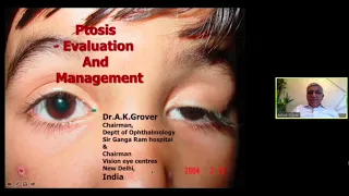Congenital ptosis evaluation and management : An interactive webinar  - Dr A K Grover