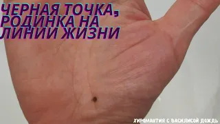 Точка, пятно, родинка на линии жизни. Линия сглаза, здоровье на фото рук. Хиромантия