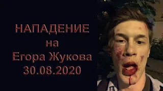 Нападение на Егора Жукова в Москве 30.08.2020