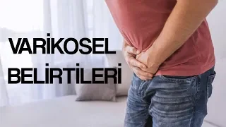 Varikosel Belirtileri !!