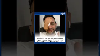 إصابة مصطفي قمر في عينه خلال تصوير أولاد حريم كريم وتوقف التصوير ٣ أيام