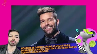 Hombre se operó más de 30 veces para parecerse a Ricky Martin y los resultados fueron desastrosos