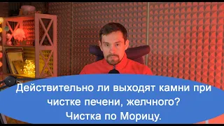 Действительно ли выходят камни при чистке печени, желчного? Чистка по Морицу.