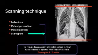 Normal CT chest Dr Mamdouh Mahfouz 480p 23fps H264 128kbit AAC