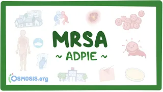 MRSA: Nursing Process