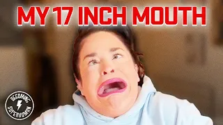 I Have The World's Biggest Mouth | Samantha Ramsdell