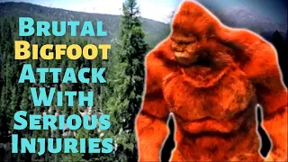 Bigfoot Attack Serious Injuries Mystery Terrifying. True SAROY Story | (Strange But True Stories!)