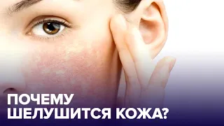 Почему КОЖА ШЕЛУШИТСЯ и как ее спасти?