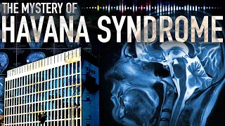 What is Havana Syndrome? The Mysterious Illness in U.S. Embassies