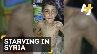 Children Are Starving To Death In Madaya, Syria