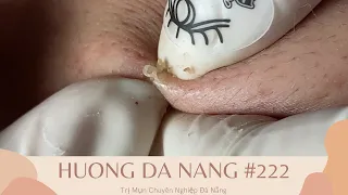 #222 | Huong Da Nang - Mr. Doanh Part 2