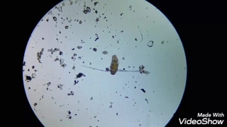 Water Bear ( Tardigrade ) with Microscope HD