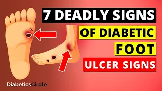 7 DEADLY Diabetic FOOT Ulcer Signs