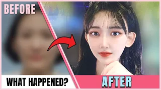 [SUB] TOP 5 FANTASTIC PLASTIC SURGERY TRANSFORMATIONS | BEFORE AND AFTER MAKE-OVERS