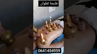 الحجامة الدموية و الجافة النارية مركز الحجامة بطنجة تطوان 0641454959 centre hijama Tanger Tetouan