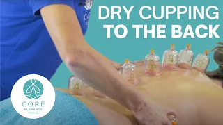 Clinical Dry Cupping to the Back including the spinous processes