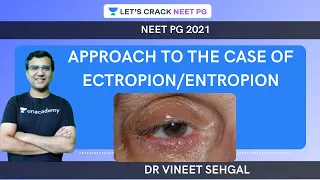 Approach to the case of Ectropion/Entropion |  NEET-PG 2021 | Vineet Sehgal