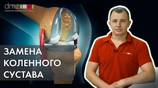 СЕКРЕТЫ ЗАМЕНЫ КОЛЕННОГО СУСТАВА: операция, протезы Zimmer и восстановление