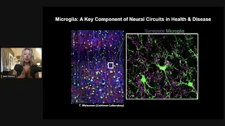 Redefining Microglia States and Function in Alzheimer’s Disease