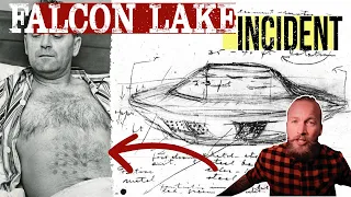 Falcon Lake Incident.  Did this man really get burnt from a UFO?