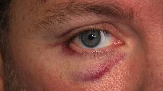 Road rage victim wants suspects charged for beating