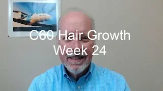 C60 Hair Growth: Week 24 In The Books - It's Really Beginning To Show