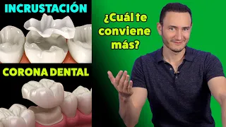 Incrustación vs Corona Dental ¿Cuál te conviene más? | (Cuando está indicada)